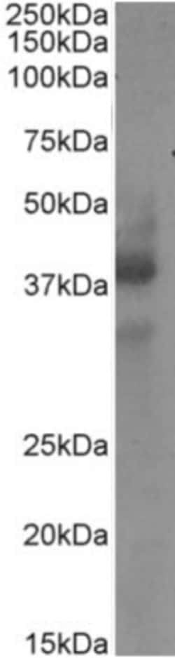Invitrogen CD34 Chimeric Recombinant Rabbit Monoclonal Antibody (My10)