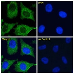 Invitrogen CD299 (DC-SIGN/L) Chimeric Recombinant Rabbit Monoclonal Antibody