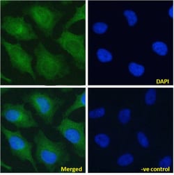 Invitrogen NOTCH2 Chimeric Recombinant Rabbit Monoclonal Antibody (B9)