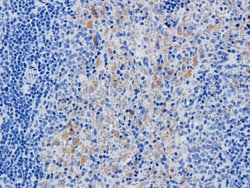 Invitrogen Daclizumab Recombinant Human Monoclonal Antibody (Daclizumab)