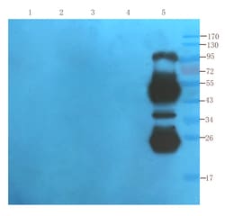 Invitrogen Daclizumab Recombinant Human Monoclonal Antibody (Daclizumab)