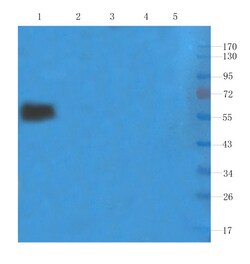 Invitrogen Basiliximab Chimeric Recombinant Human Monoclonal Antibody (Basiliximab)
