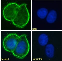Invitrogen MUC1 Chimeric Recombinant Rabbit Monoclonal Antibody (SM3) 200