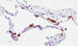 Invitrogen MUC1 Chimeric Recombinant Rabbit Monoclonal Antibody (SM3) 200