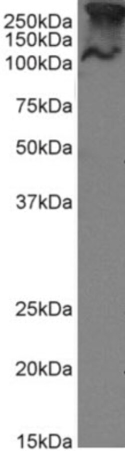 Invitrogen MUC1 Chimeric Recombinant Rabbit Monoclonal Antibody (SM3) 200