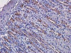 Invitrogen Cetuximab Recombinant Human Monoclonal Antibody (C225 (Cetuximab)) 200 &mu;g | Buy Online | Invitrogen&trade; | Fisher Scientific