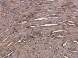 Invitrogen Arcitumomab Recombinant Human Monoclonal Antibody (Arcitumomab)