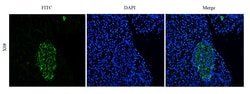 Invitrogen Arcitumomab Recombinant Human Monoclonal Antibody (Arcitumomab)