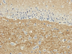 Invitrogen SNAP25 Recombinant Mouse Monoclonal Antibody (SP12) 200 &mu;g;