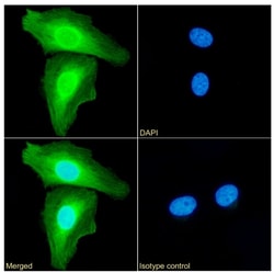 Invitrogen Annexin A1 Recombinant Rabbit Monoclonal Antibody (SAIC-13B-19)