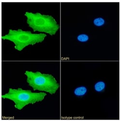 Invitrogen Calreticulin Recombinant Rabbit Monoclonal Antibody (SAIC-16D-6B9)