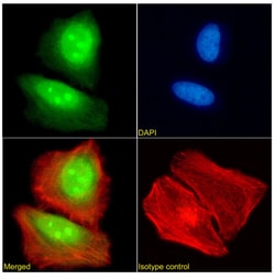 Invitrogen FEN1 Recombinant Rabbit Monoclonal Antibody (SAIC-21C-4) 200