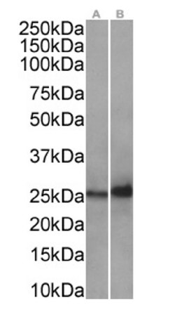 Invitrogen HSP27 Recombinant Rabbit Monoclonal Antibody (SAIC-23B-22) 200