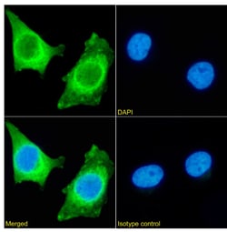 Invitrogen HSP27 Recombinant Rabbit Monoclonal Antibody (SAIC-23E-30) 200 &mu;g | Buy Online | Invitrogen&trade; | Fisher Scientific