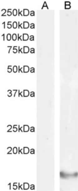 Invitrogen IL-18 Recombinant Rabbit Monoclonal Antibody (SAIC-24B-4) 200