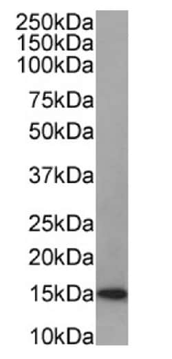 Invitrogen Galectin 1 Recombinant Rabbit Monoclonal Antibody (SAIC-25B-112)