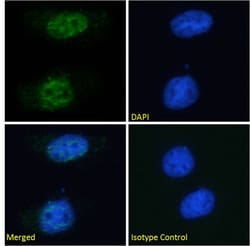Invitrogen PCNA Recombinant Rabbit Monoclonal Antibody (SAIC-27C-101) 200