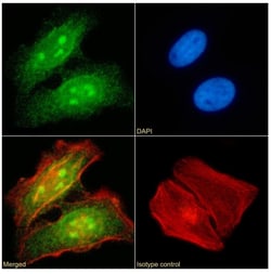 Invitrogen RAD23B Recombinant Rabbit Monoclonal Antibody (SAIC-28A-29)