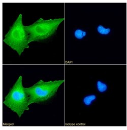 Invitrogen gamma Synuclein Recombinant Rabbit Monoclonal Antibody (SAIC-31A-10)