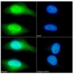 Invitrogen TAGLN Recombinant Rabbit Monoclonal Antibody (SAIC-33B-129)