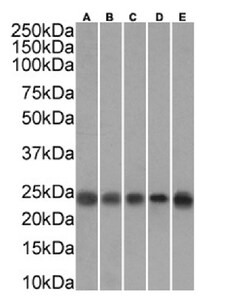 Invitrogen TAGLN Recombinant Rabbit Monoclonal Antibody (SAIC-33B-129)