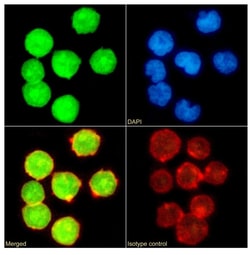 Invitrogen UBC9 Recombinant Rabbit Monoclonal Antibody (SAIC-36A-9) 200