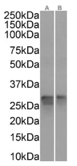 Invitrogen PRDX4 Recombinant Rabbit Monoclonal Antibody (SAIC-40A-24) 200