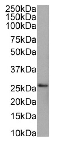 Invitrogen PRDX4 Recombinant Rabbit Monoclonal Antibody (SAIC-40C-8) 200