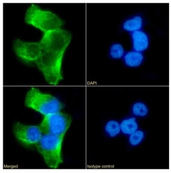 Invitrogen SERPINA6 Recombinant Rabbit Monoclonal Antibody (SAIC-42B-10)