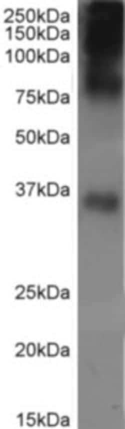 Invitrogen Rhodopsin Recombinant Rabbit Monoclonal Antibody (Rho 1D4) 200