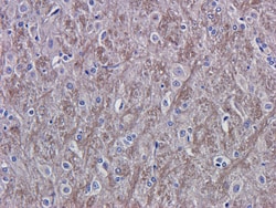 Invitrogen VEGF Recombinant Mouse Monoclonal Antibody (A.4.6.1) 200 &mu;g | Buy Online | Invitrogen&trade; | Fisher Scientific