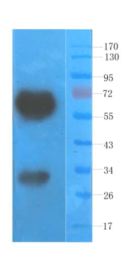Invitrogen VEGF Recombinant Mouse Monoclonal Antibody (A.4.6.1) 200 &mu;g | Buy Online | Invitrogen&trade; | Fisher Scientific