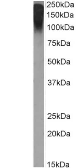 Invitrogen MUC1 Chimeric Recombinant Rabbit Monoclonal Antibody (Mc5) 200