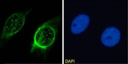 Invitrogen MMP14 Recombinant Mouse Monoclonal Antibody (LEM-2/15) 200 &mu;g;