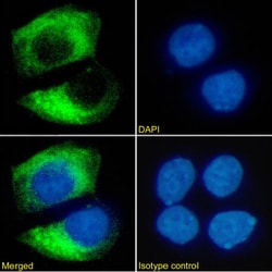 Invitrogen ErbB2 (HER-2) Recombinant Mouse Monoclonal Antibody (SER4) 200