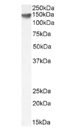 Invitrogen ErbB2 (HER-2) Recombinant Mouse Monoclonal Antibody (SER4) 200