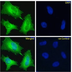 Invitrogen EDB-FN Chimeric Recombinant Rabbit Monoclonal Antibody (A2)