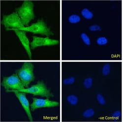 Invitrogen EDB-FN Chimeric Recombinant Rabbit Monoclonal Antibody (G4)