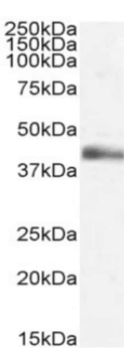 Invitrogen TNF beta Chimeric Recombinant Rabbit Monoclonal Antibody (3F12.2D3) 200 &mu;g | Buy Online | Invitrogen&trade; | Fisher Scientific