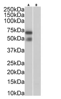 Invitrogen Podoplanin Chimeric Recombinant Rabbit Monoclonal Antibody (PMab-1)