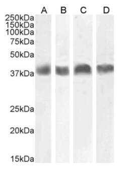 Invitrogen Podoplanin Chimeric Recombinant Rabbit Monoclonal Antibody (PMab-1)
