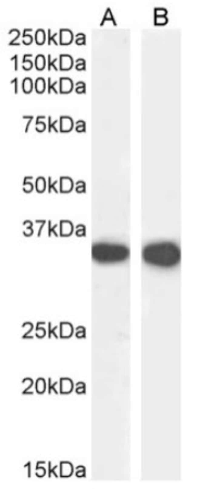 Invitrogen CD74 Chimeric Recombinant Rabbit Monoclonal Antibody (In-1 ...