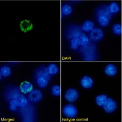 Invitrogen MHC Class I Chimeric Recombinant Rabbit Monoclonal Antibody