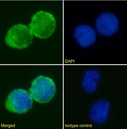 Invitrogen&trade;&nbsp;CD25 Chimeric Recombinant Rabbit Monoclonal Antibody (AHT107)