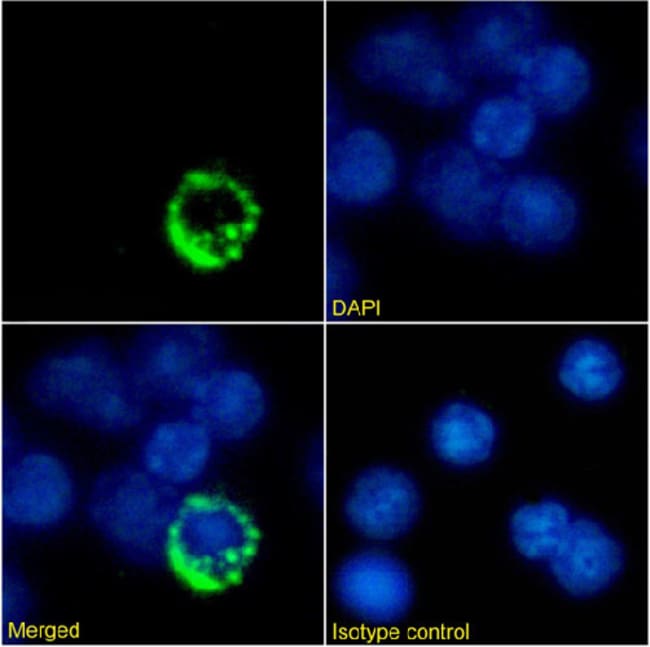 TCR Alpha + TCR Beta Monoclonal Antibody [KJ1298]