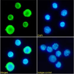 Invitrogen Hemoglobin Chimeric Recombinant Rabbit Monoclonal Antibody (2A1)
