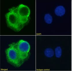 Invitrogen TRAIL-R2 (DR5) Chimeric Recombinant Rabbit Monoclonal Antibody