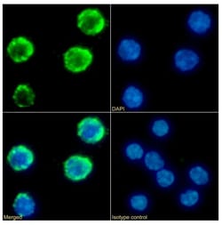 Invitrogen IFNGR1 (CD119) Chimeric Recombinant Rabbit Monoclonal Antibody