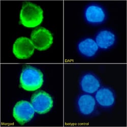 Invitrogen RHD Chimeric Recombinant Rabbit Monoclonal Antibody (D7C2) 200