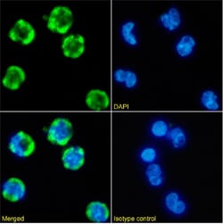 Invitrogen CD35 Chimeric Recombinant Rabbit Monoclonal Antibody (E11) 200 &mu;g | Buy Online | Invitrogen&trade; | Fisher Scientific